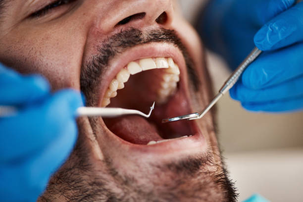 Best Cosmetic Emergency Dentistry in Richfield, UT